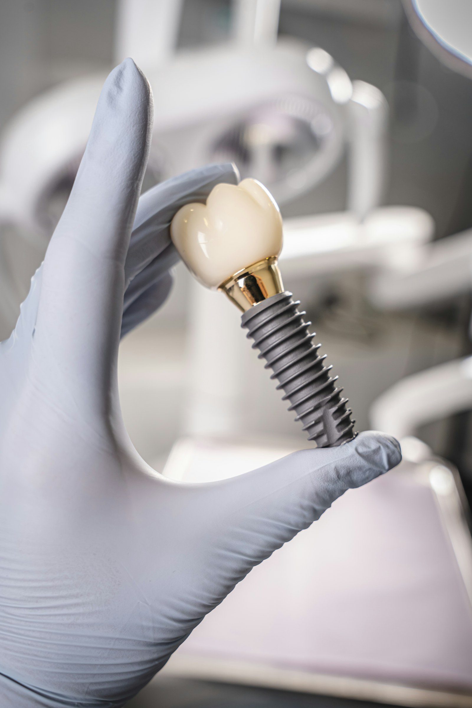 Eldivenli parmakların tuttuğu bir model: vida biçimli bir implant ve üstünde bir diş kronu